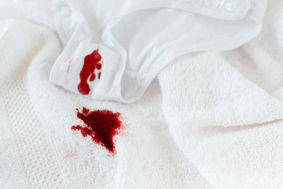 Cómo quitar la sangre de menstruación de la ropa: métodos efectivos